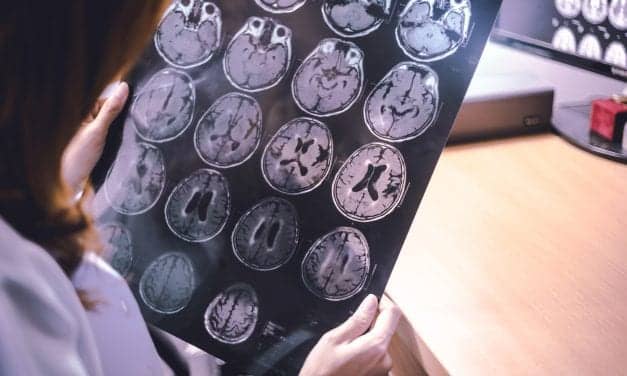 Cilcare Study to Explore Hearing in Patients with Neurodegenerative Diseases 